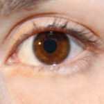 EyeInj EyeInj