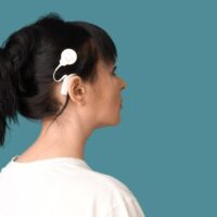 cochlear implant cochlear implant